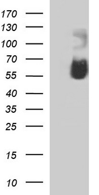 PARVB Antibody