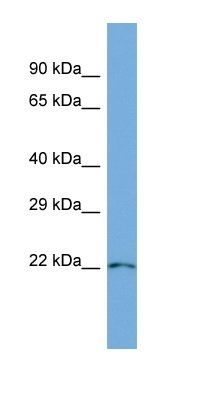 PARVG antibody