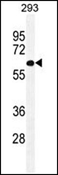 PATL2 antibody