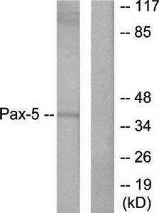 Pax-5 antibody