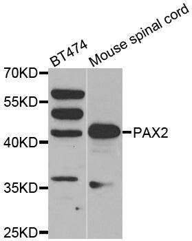 PAX2 antibody