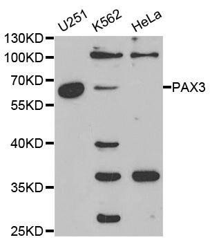 PAX3 antibody