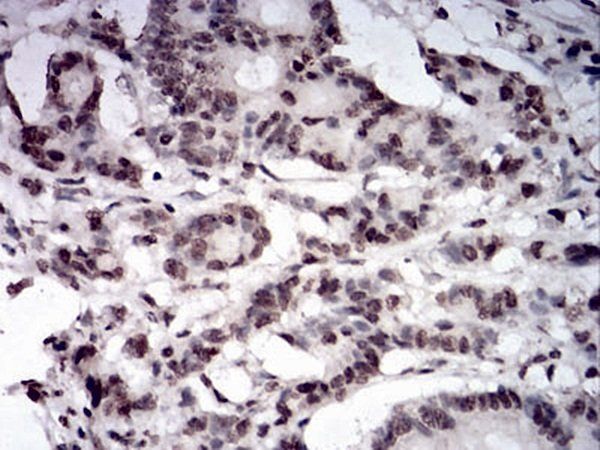 PAX6 Antibody