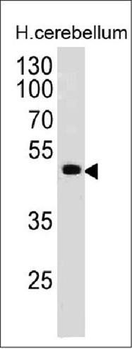 PAX6 (Stem Cell Marker) Antibody