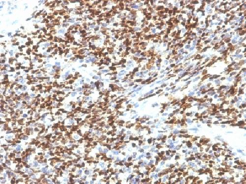 PAX7 (Rhabdomyosarcoma Marker) Antibody