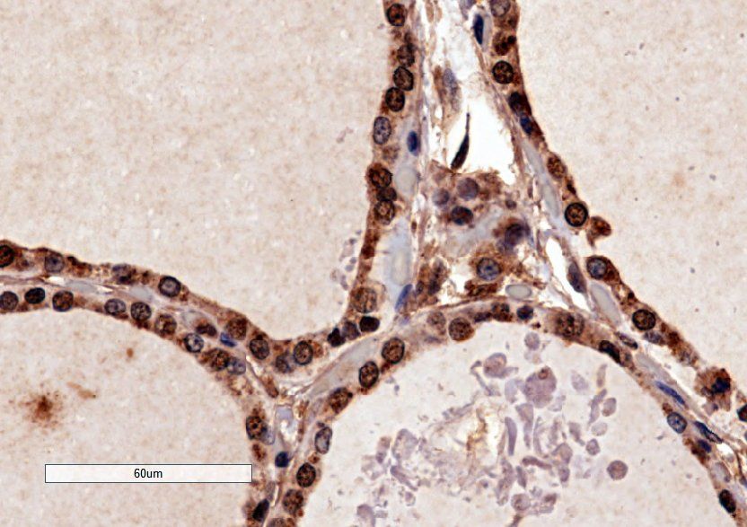Goat anti-PAX8 (N Terminus) Antibody