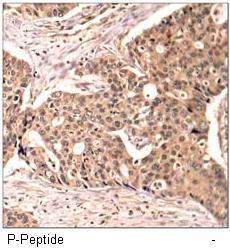 Paxillin (Phospho-Tyr118) Antibody