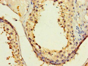 PAXIP1 Antibody