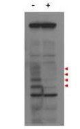 PBIP1 antibody