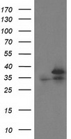 PBLD antibody