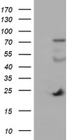 PBX1 Antibody