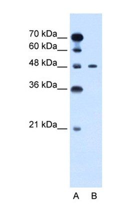 PBX1 antibody