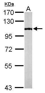 PCAF Rabbit Polyclonal Antibody