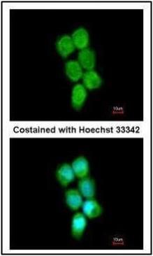 PCBP2 antibody [N1C1]