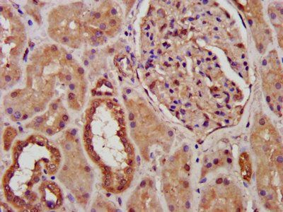 PCCB Antibody