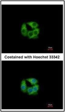 PCCB antibody [N2C3]