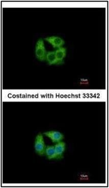 PCCB antibody