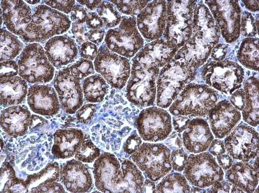 PCCB Rabbit Polyclonal Antibody