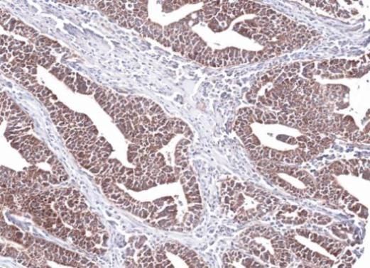 PCCB Rabbit Polyclonal Antibody