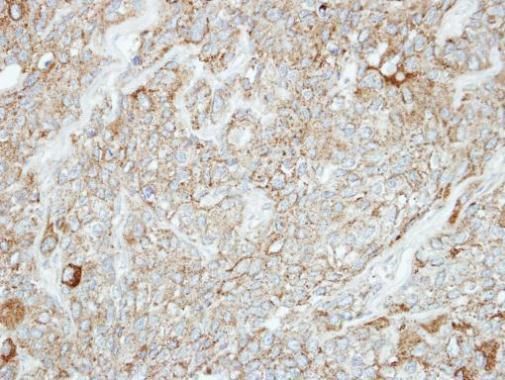 PCDH1 antibody [C2C3], C-term