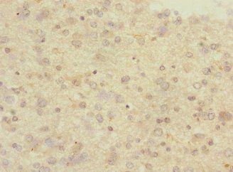 PCDH10 Antibody