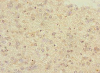 PCDH10 antibody