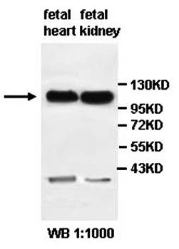 PCDH10 Rabbit Polyclonal Antibody