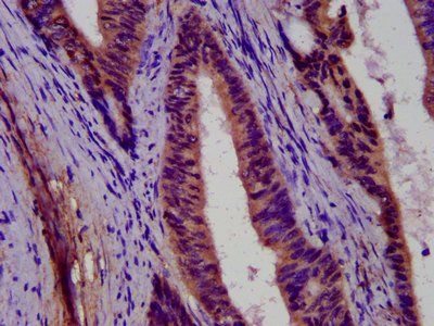PCDH11X Antibody