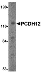 PCDH12 Antibody