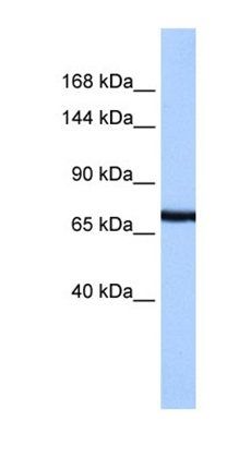 PCDH15 antibody