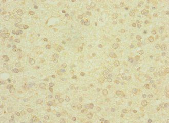 PCDH19 Antibody