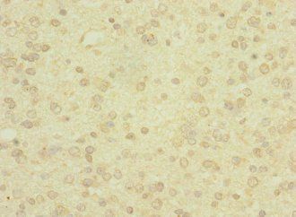 PCDH19 antibody