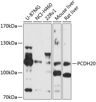 PCDH20 antibody