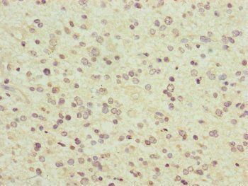 PCDHA12 Antibody