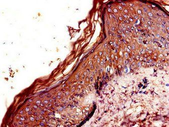 CNR2 Antibody