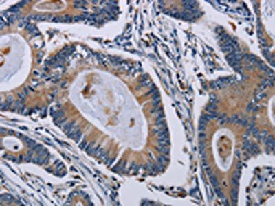 PCDHAC1 Antibody