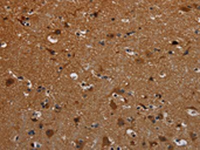 PCDHB15 Antibody