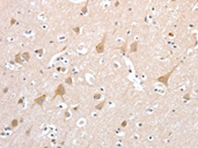 PCDHB16 Antibody