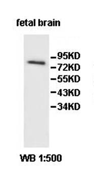 PCDHB16 antibody
