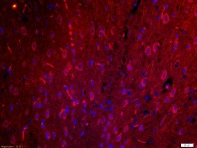 PCDHGA10 antibody