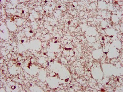 PCGF1 Antibody