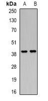 PCGF6 antibody