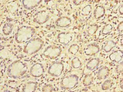 PCIF1 Antibody