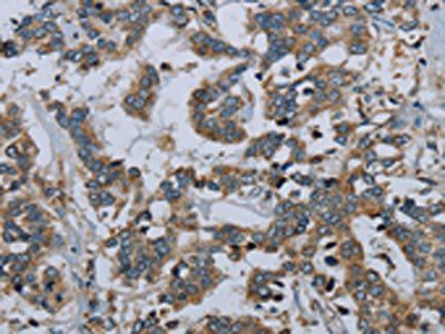 PCK2 Antibody