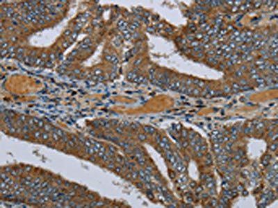 PCK2 Antibody