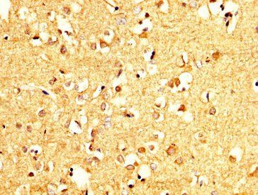 PCMT1 Antibody