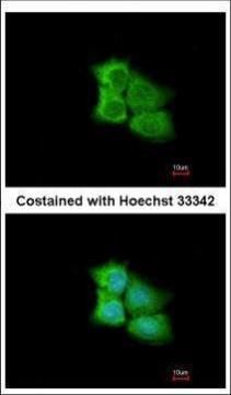 PCMT1 antibody