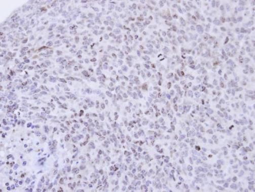 PCNP antibody [N1N2], N-term