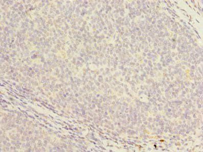 PCOLCE2 Antibody