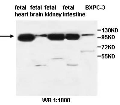 PCSK5 Rabbit Polyclonal Antibody